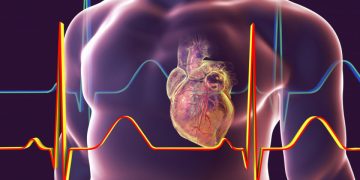 High blood pressure, high cholesterol early in life tied to heart problems