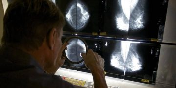 Study finds Google system could improve breast cancer detection